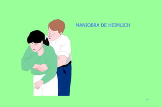 MANIOBRA DE HEIMLICH 