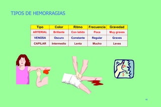 TIPOS DE HEMORRAGIAS 