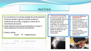 FRACTURAS

 