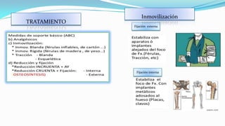 TRATAMIENTO

Inmovilización
Fijación externa

Fijación interna

 