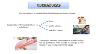 Una quemadura es un tipo de lesión en la piel causada por diversos factores.

llamas
Las quemaduras térmicas se producen por
el contacto con:

líquidos calientes
superficies calientes

El tratamiento inmediato como medida de primeros auxilios
para las quemaduras leves consiste en sumergir el área
afectada en agua fresca para enfriar los tejidos.

 