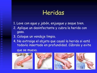 Heridas
1. Lave con agua y jabón, enjuague y seque bien.
2. Aplique un desinfectante y cubra la herida con
gasa.
3. Coloque un vendaje limpio.
4. No extraiga el objeto que causó la herida si está
todavía insertado en profundidad. Cúbralo y evite
que se mueva.
 