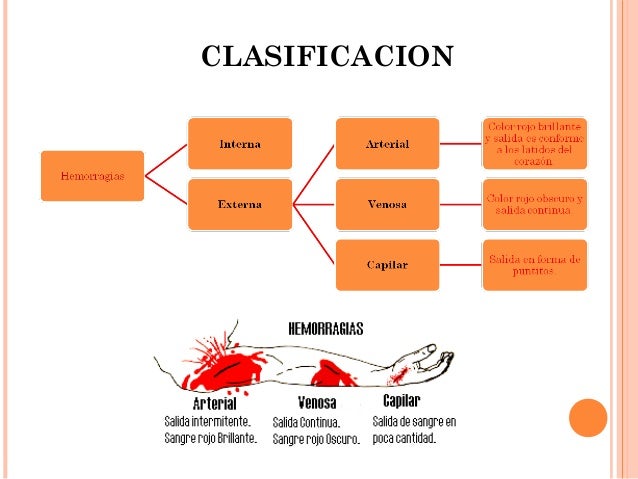 Primeros auxilios