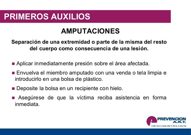 La metodología para el aumento del miembro con la ex licitación