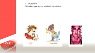 • Situacional
Estimulado por alguna maniobra de vasalva.
 