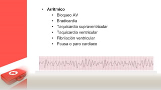 • Arritmico
• Bloqueo AV
• Bradicardia
• Taquicardia supraventricular
• Taquicardia ventricular
• Fibrilación ventricular
• Pausa o paro cardiaco
 