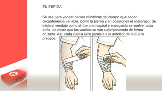 EN ESPIGA
Se usa para vendar partes cilíndricas del cuerpo que tienen
circunferencia variable, como la pierna y en ocasiones el antebrazo. Se
inicia el vendaje como si fuera en espiral y enseguida se vuelve hacia
atrás, de modo que las vueltas se van superponiendo de forma
cruzada. Así, cada vuelta será paralela a la anterior de la que le
precede.
 