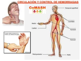 CIRCULACIÓN Y CONTROL DE HEMORRAGIAS
 