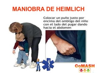 MANIOBRA DE HEIMLICH
 