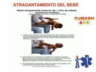 ATRAGANTAMIENTO DEL BEBÉ
 
