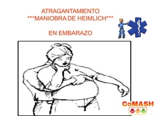 ATRAGANTAMIENTO
***MANIOBRA DE HEIMLICH***
EN EMBARAZO
 