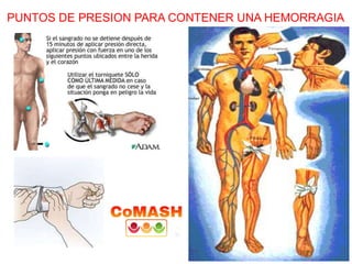 PUNTOS DE PRESION PARA CONTENER UNA HEMORRAGIA
 