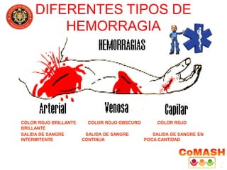 DIFERENTES TIPOS DE
HEMORRAGIA
COLOR ROJO BRILLANTE COLOR ROJO OBSCURO COLOR ROJO
BRILLANTE
SALIDA DE SANGRE SALIDA DE SANGRE SALIDA DE SANGRE EN
INTERMITENTE CONTINUA POCA CANTIDAD
 