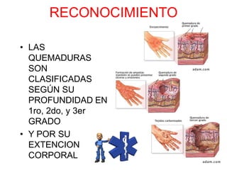 RECONOCIMIENTO
• LAS
QUEMADURAS
SON
CLASIFICADAS
SEGÚN SU
PROFUNDIDAD EN
1ro, 2do, y 3er
GRADO
• Y POR SU
EXTENCION
CORPORAL
 