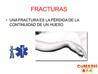 FRACTURAS
• UNA FRACTURA ES LA PÉRDIDA DE LA
CONTINUIDAD DE UN HUESO
 