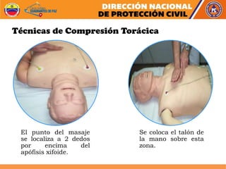 El punto del masaje
se localiza a 2 dedos
por encima del
apófisis xifoide.
Se coloca el talón de
la mano sobre esta
zona.
Técnicas de Compresión Torácica
 