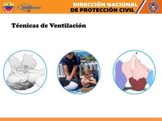 Técnicas de Ventilación
 