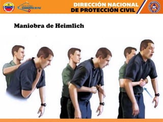 Maniobra de Heimlich
 