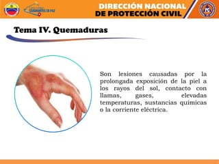 Son lesiones causadas por la
prolongada exposición de la piel a
los rayos del sol, contacto con
llamas, gases, elevadas
temperaturas, sustancias químicas
o la corriente eléctrica.
Tema IV. Quemaduras
 