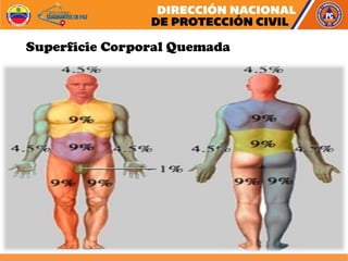 Superficie Corporal Quemada
 