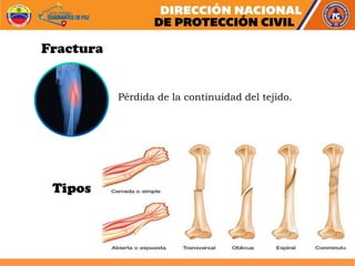 Pérdida de la continuidad del tejido.
Fractura
Tipos
 