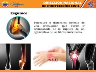 Torcedura o distensión violenta de
una articulación que puede ir
acompañada de la ruptura de un
ligamento o de las fibras musculares.
Esguince
 