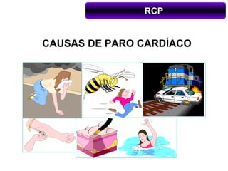 RCP


CAUSAS DE PARO CARDÍACO
 