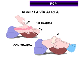 RCP

    ABRIR LA VÍA AÉREA


             SIN TRAUMA




CON TRAUMA
 