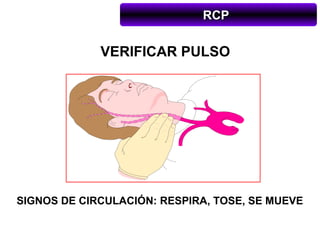 RCP

             VERIFICAR PULSO




SIGNOS DE CIRCULACIÓN: RESPIRA, TOSE, SE MUEVE
 