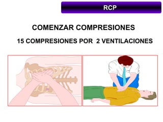 RCP


   COMENZAR COMPRESIONES
15 COMPRESIONES POR 2 VENTILACIONES
 