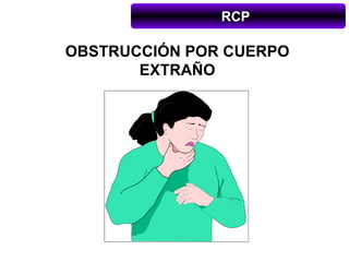 RCP

OBSTRUCCIÓN POR CUERPO
       EXTRAÑO
 