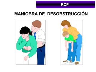 RCP

MANIOBRA DE DESOBSTRUCCIÓN
 