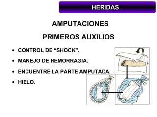 HERIDAS

             AMPUTACIONES
           PRIMEROS AUXILIOS
• CONTROL DE “SHOCK”.

• MANEJO DE HEMORRAGIA.

• ENCUENTRE LA PARTE AMPUTADA.

• HIELO.
 