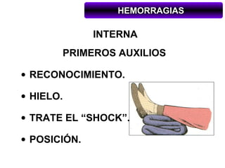 HEMORRAGIAS

              INTERNA
       PRIMEROS AUXILIOS

• RECONOCIMIENTO.

• HIELO.

• TRATE EL “SHOCK”.

• POSICIÓN.
 