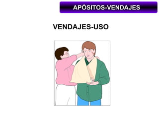 APÓSITOS-VENDAJES


VENDAJES-USO
 