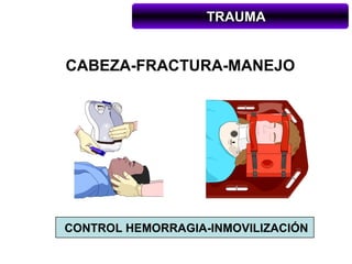 TRAUMA


CABEZA-FRACTURA-MANEJO




CONTROL HEMORRAGIA-INMOVILIZACIÓN
 