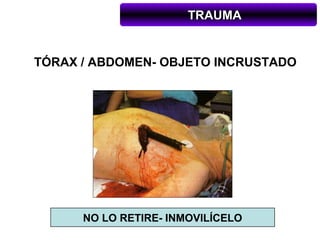 TRAUMA


TÓRAX / ABDOMEN- OBJETO INCRUSTADO




      NO LO RETIRE- INMOVILÍCELO
 