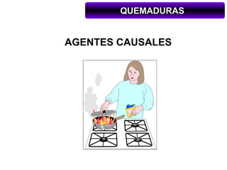 QUEMADURAS


AGENTES CAUSALES
 