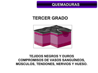 QUEMADURAS


        TERCER GRADO




      TEJIDOS NEGROS Y DUROS
 COMPROMISOS DE VASOS SANGUÍNEOS,
MÚSCULOS, TENDONES, NERVIOS Y HUESO.
 
