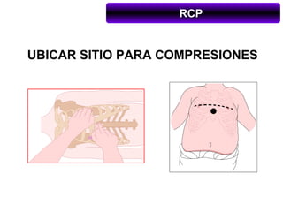 RCP


UBICAR SITIO PARA COMPRESIONES
 