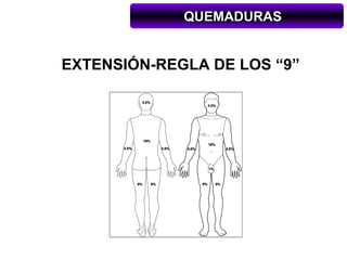 QUEMADURAS


EXTENSIÓN-REGLA DE LOS “9”
 