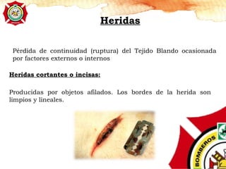 Pérdida de continuidad (ruptura) del Tejido Blando ocasionada
por factores externos o internos
Heridas
Heridas cortantes o incisas:
Producidas por objetos afilados. Los bordes de la herida son
limpios y lineales.
 