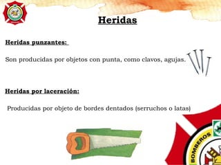Heridas
Heridas punzantes:
Son producidas por objetos con punta, como clavos, agujas.
Heridas por laceración:
Producidas por objeto de bordes dentados (serruchos o latas)
 