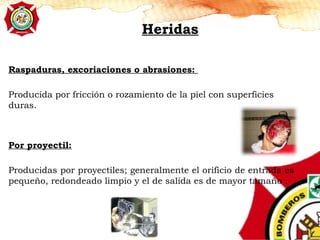 Raspaduras, excoriaciones o abrasiones:
Producida por fricción o rozamiento de la piel con superficies
duras.
Heridas
Por proyectil:
Producidas por proyectiles; generalmente el orificio de entrada es
pequeño, redondeado limpio y el de salida es de mayor tamaño .
 