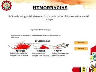 HEMORRAGIAS
Salida de sangre del sistema circulatorio por orificios o cavidades del
cuerpo
 