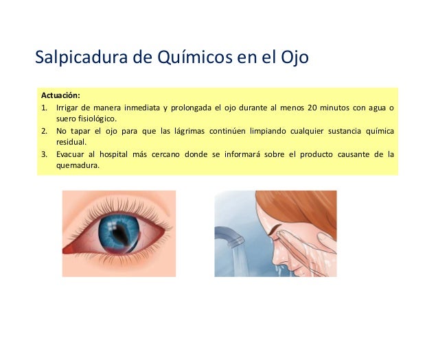 Salpicadura De Reactivos En Los Ojos