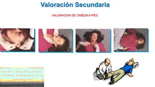 VALORACION DE CABEZA A PIES
Valoración Secundaria
 