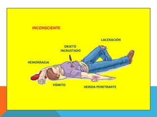 VÓMITO
HEMORRAGIA
OBJETO
INCRUSTADO
LACERACIÓN
HERIDA PENETRANTE
INCONSCIENTE
 