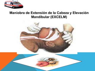 Maniobra de Extensión de la Cabeza y Elevación
Mandibular (EXCELM)
 