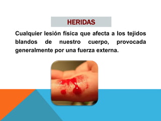 HERIDAS
Cualquier lesión física que afecta a los tejidos
blandos de nuestro cuerpo, provocada
generalmente por una fuerza externa.
 